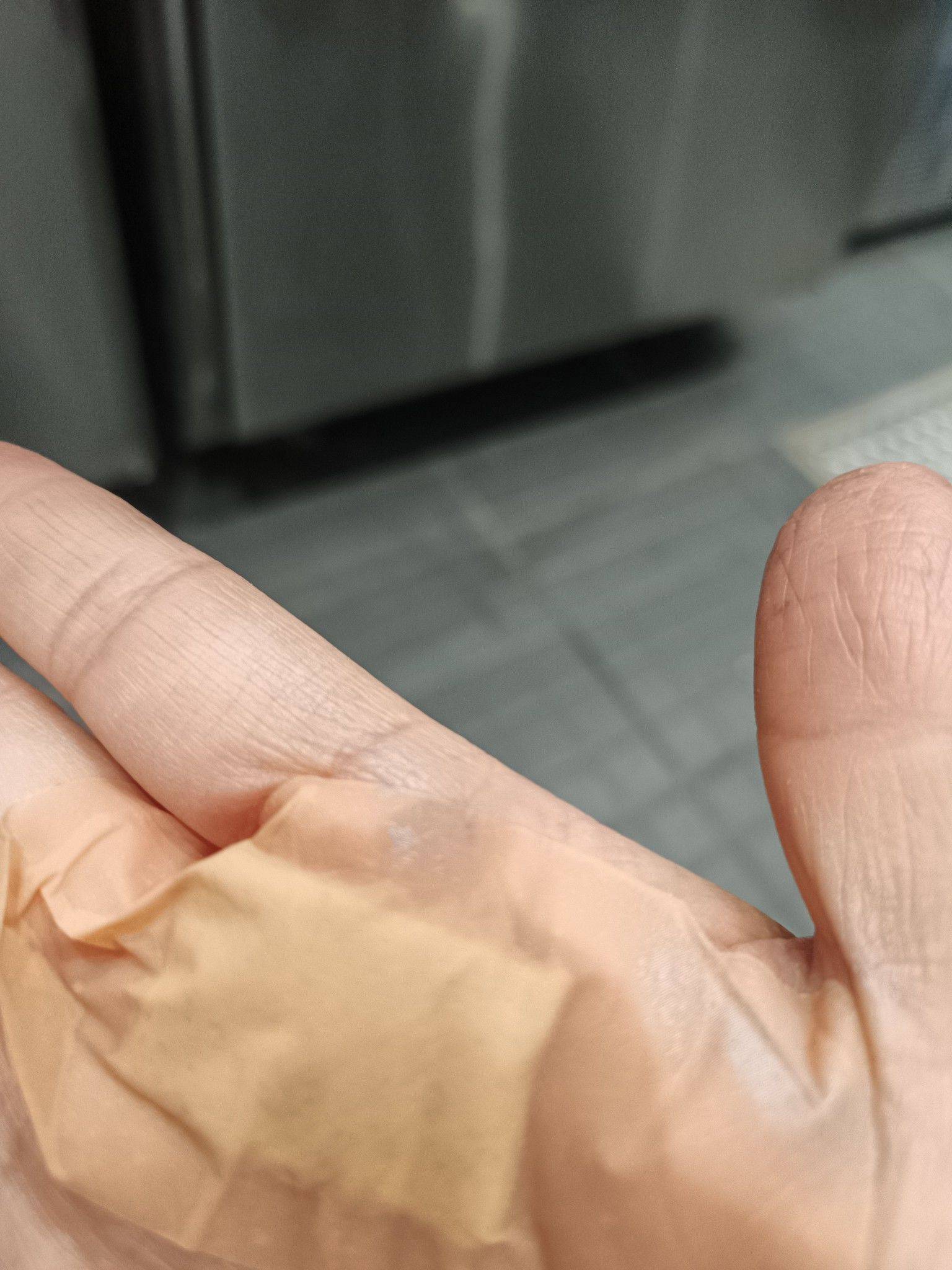  在线蹲室友 我的手啥时候能好